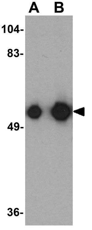 KREMEN1 antibody