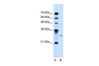 AGPAT2 antibody, C-term