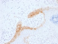 Cytokeratin 15 antibody [KRT15/1699]