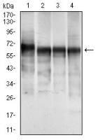 Cytokeratin 5 antibody [2C2B4]