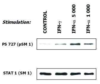STAT1 antibody [SM1]