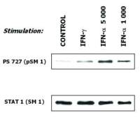 STAT1 antibody [SM1]