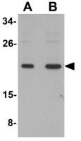 SUMO3 antibody