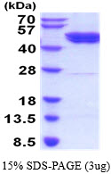 Human GSK3 beta protein, His tag