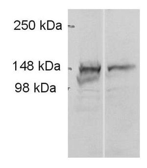 ADAMTS9 antibody