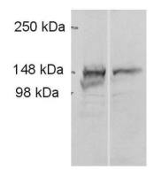 ADAMTS9 antibody
