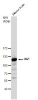 O-GlcNAc transferase antibody