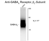 GABA A Receptor beta 2 antibody