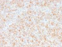 TNF alpha antibody [SPM543]