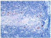 IL2 Receptor alpha antibody [MAB0710]