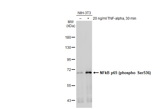 NFkB p65 (phospho Ser536) antibody