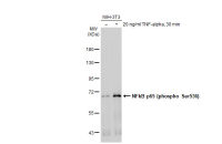 NFkB p65 (phospho Ser536) antibody