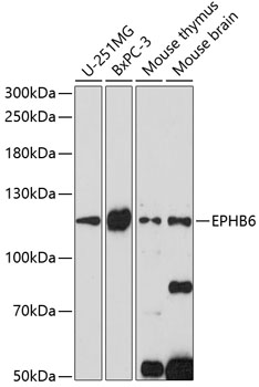 EphB6 antibody