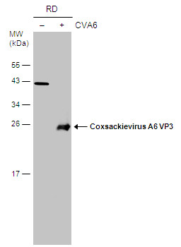 Coxsackievirus A6 VP3 antibody