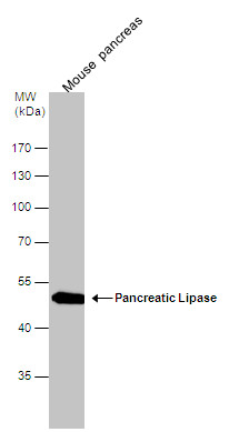 Pancreatic Lipase antibody [N3C3]