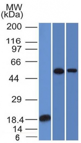 TOX3 antibody [TOX3/1124]
