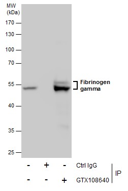 Fibrinogen gamma antibody