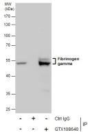 Fibrinogen gamma antibody