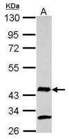 AIM2 antibody