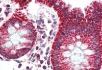 PBR antibody, C-term