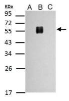 Dengue virus Envelope protein antibody