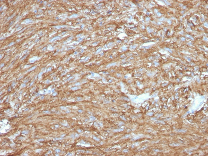 TMEM16A antibody [DG1/2831R]