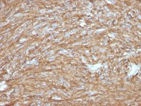 TMEM16A antibody [DG1/2831R]