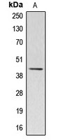 ACTBL2 antibody
