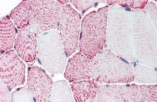 Relaxin Receptor 2 antibody