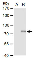 XPD antibody
