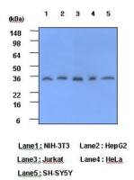 C Reactive Protein antibody [5A9]