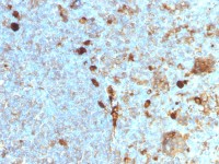 alpha 1 Antitrypsin antibody [AAT/1378]