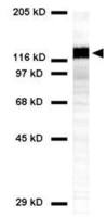 Desmoglein 3 antibody [5H10]
