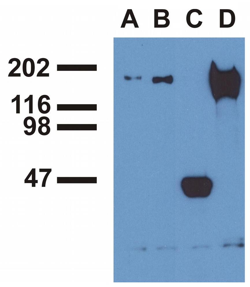 EGFR (phospho Tyr1173) antibody [EM-13]