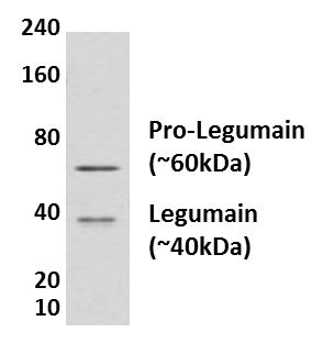 Legumain antibody [46I3]