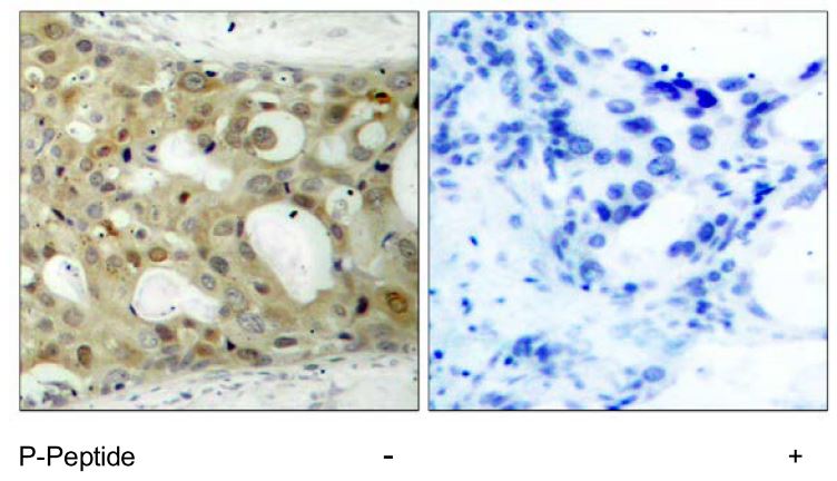 Androgen Receptor (phospho Ser650) antibody