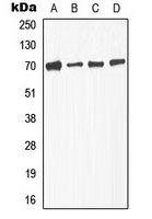 TGF beta Receptor 2 (phospho Ser225) antibody