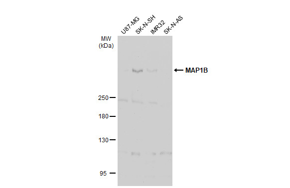 MAP1B antibody