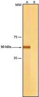 beta Tubulin antibody [2-28-33]