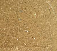 STEP / PTPN5 antibody