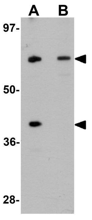 TCTN3 antibody