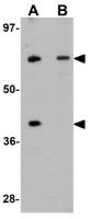 TCTN3 antibody