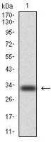 Cytokeratin 5 antibody [2C2]