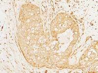 IL12A / IL12 p35 antibody