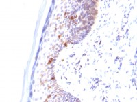 CD1a antibody [C1A/711]