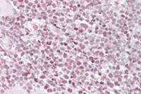 Ikaros antibody, Internal