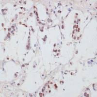 SRF (phospho Ser103) antibody