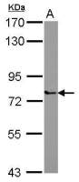 PARP6 antibody
