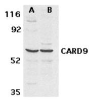 CARD9 antibody