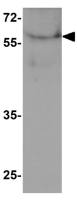PALMD antibody